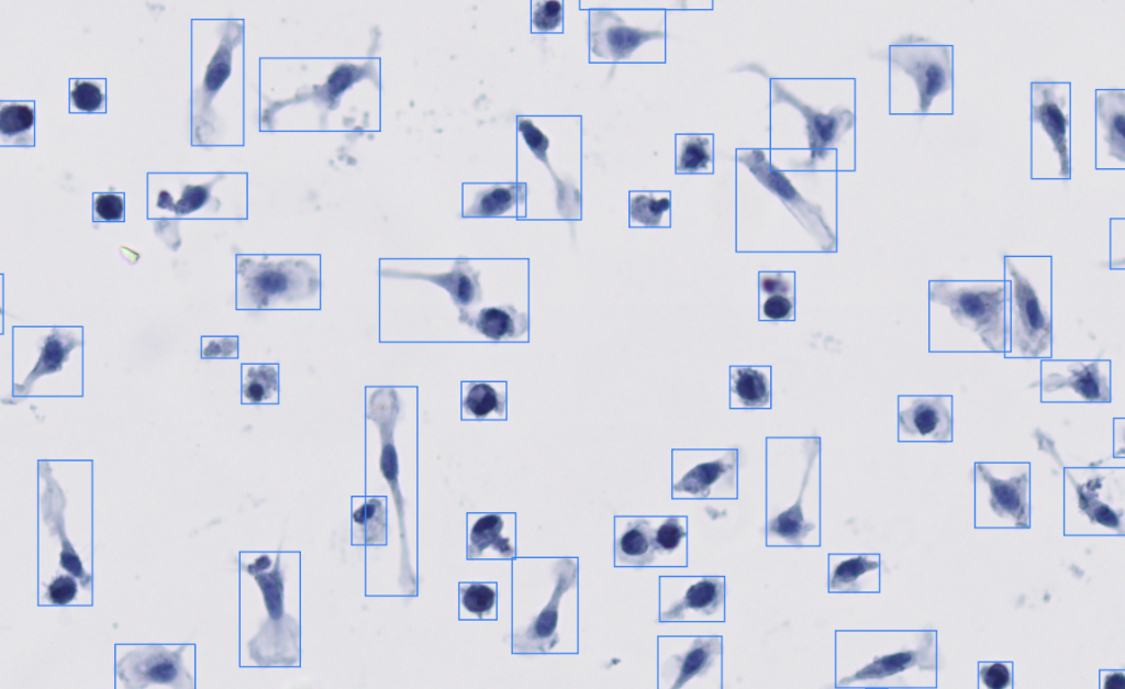 AI Cell Detection in Action